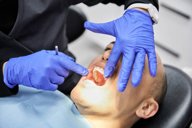 Best Emergency Dentist for Lost Fillings or Crowns in Sweetwater, TX